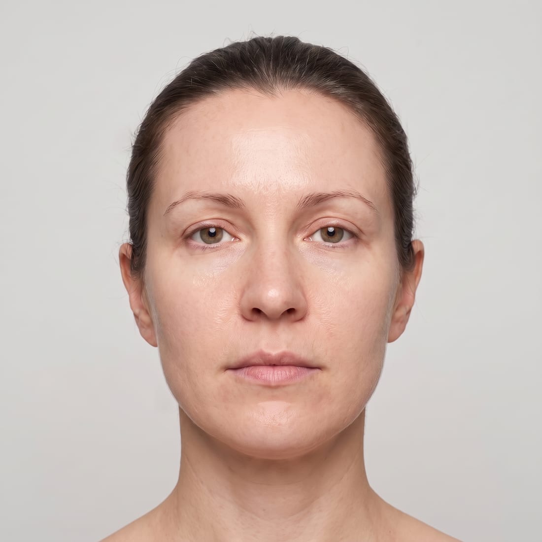 Skin after treatment course