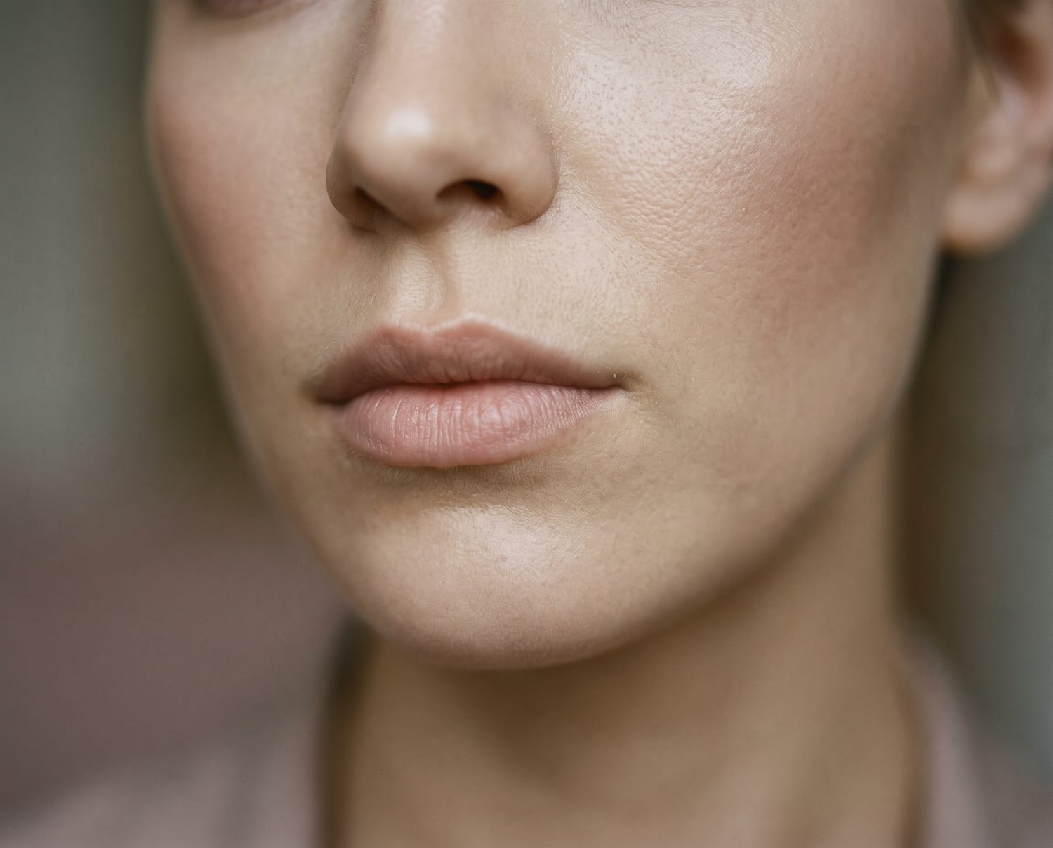 Dermal filler treatment