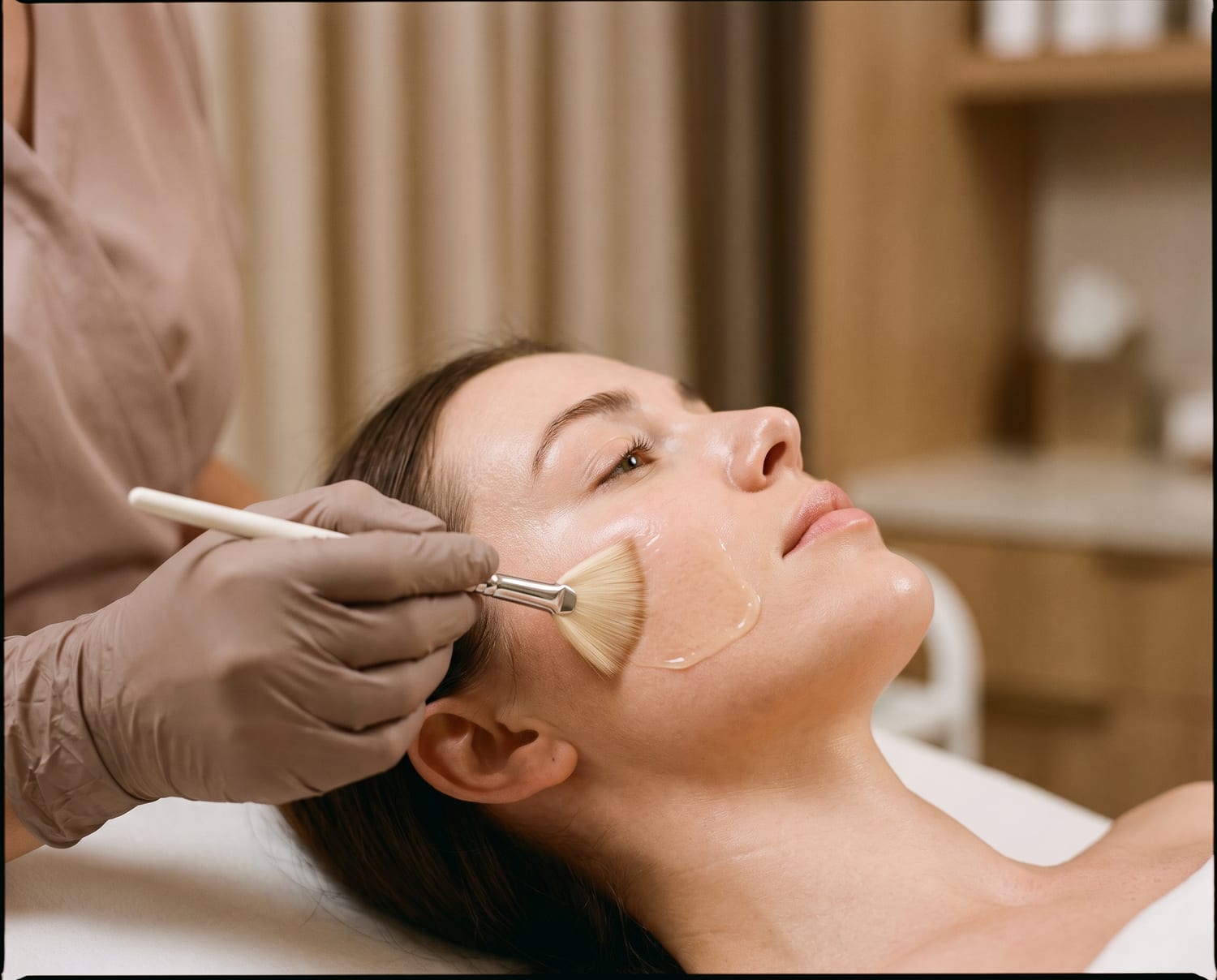 Chemical peel treatment